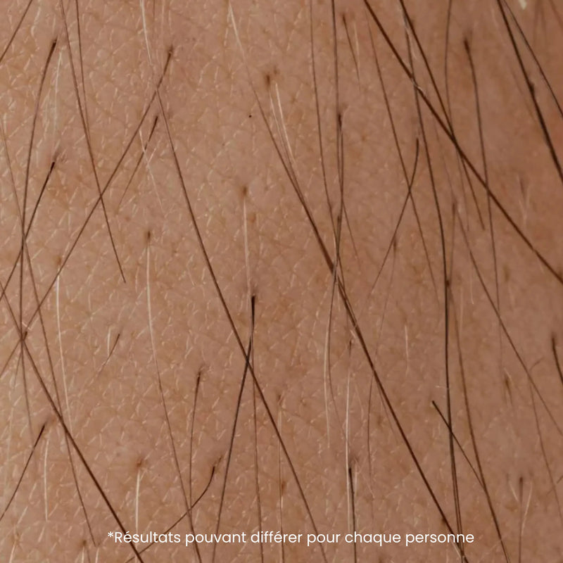 La repousse ralentie