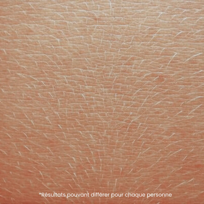 Des poils de plus en plus fins & clairs